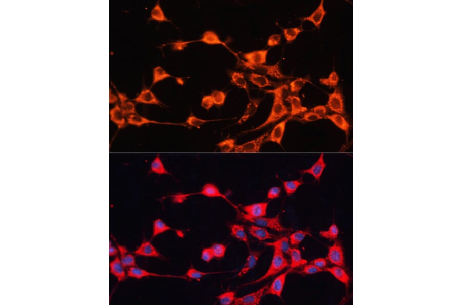 Immunofluorescence - Anti-ABCB10 Antibody (A91252) - Antibodies.com