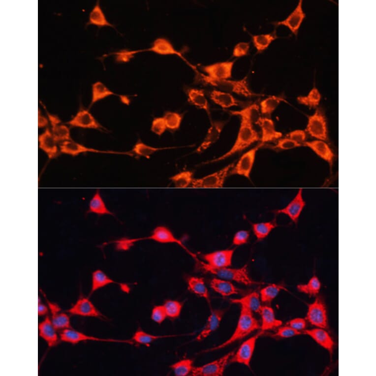 Immunofluorescence - Anti-ABCB10 Antibody (A91252) - Antibodies.com