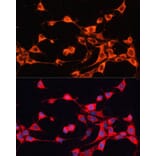 Immunofluorescence - Anti-ABCB10 Antibody (A91252) - Antibodies.com
