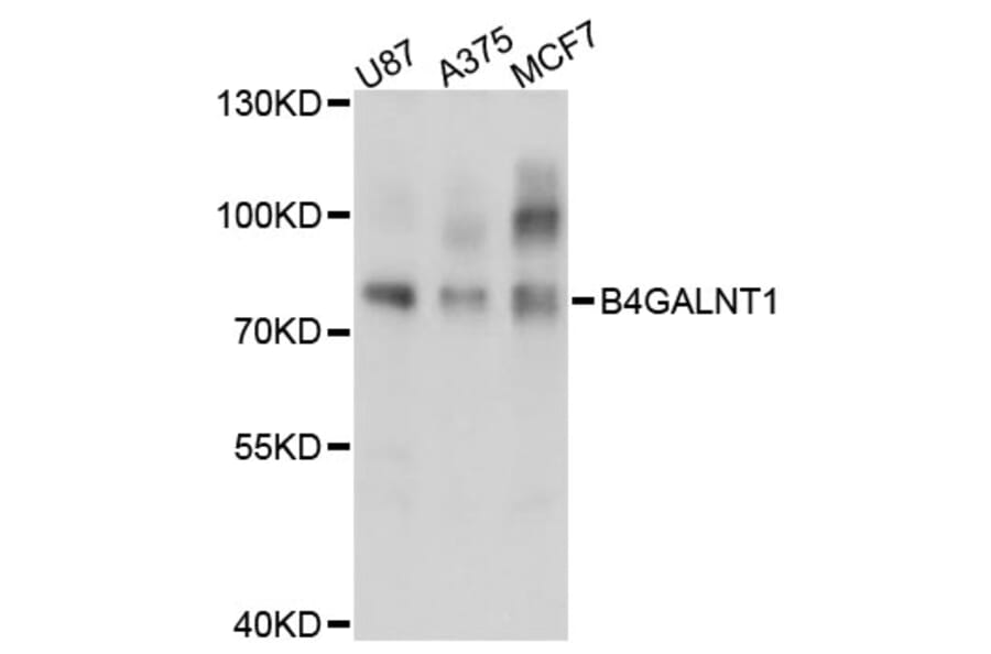 Western Blot - Anti-B4GALNT1 Antibody (A3874) - Antibodies.com