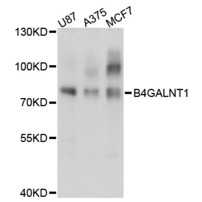Western Blot - Anti-B4GALNT1 Antibody (A3874) - Antibodies.com