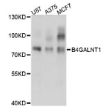 Western Blot - Anti-B4GALNT1 Antibody (A3874) - Antibodies.com