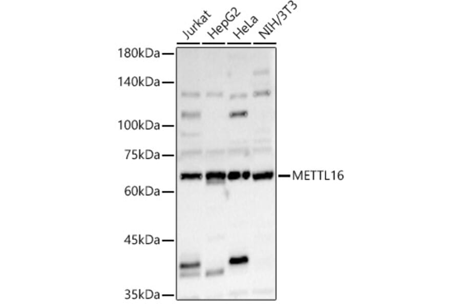 Western Blot - Anti-METTL16 Antibody (A91255) - Antibodies.com