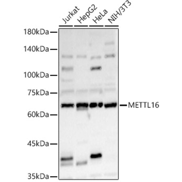 Western Blot - Anti-METTL16 Antibody (A91255) - Antibodies.com