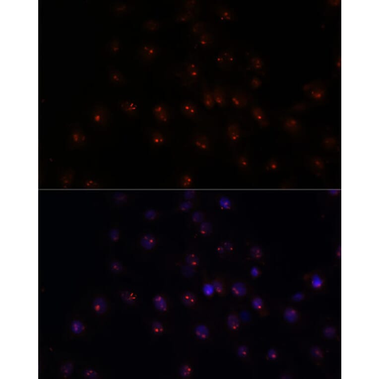 Immunofluorescence - Anti-METTL16 Antibody (A91255) - Antibodies.com