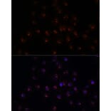 Immunofluorescence - Anti-METTL16 Antibody (A91255) - Antibodies.com