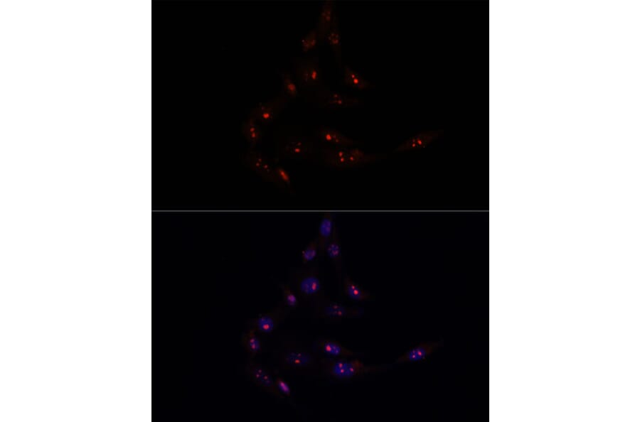 Immunofluorescence - Anti-METTL16 Antibody (A91255) - Antibodies.com