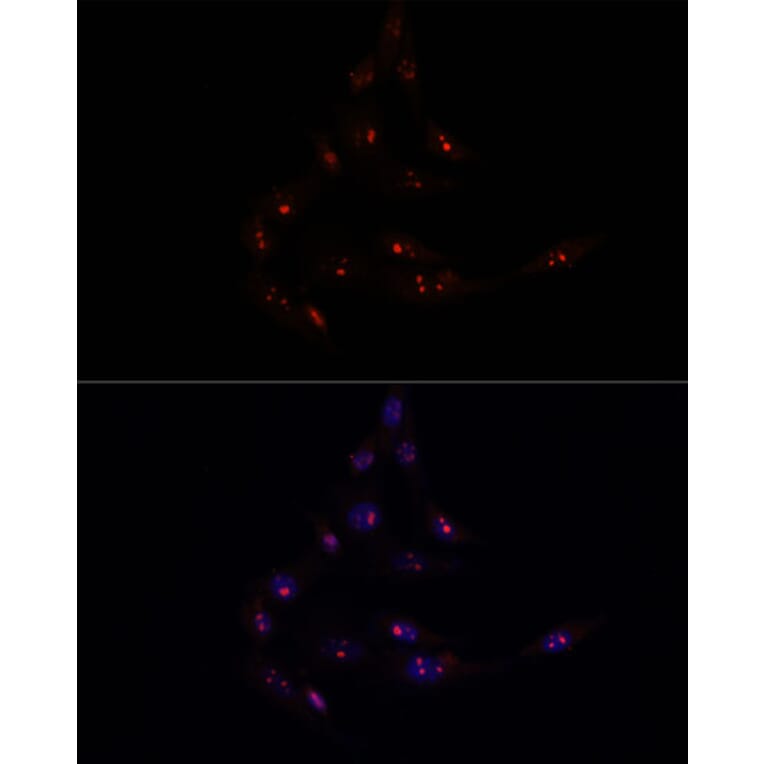 Immunofluorescence - Anti-METTL16 Antibody (A91255) - Antibodies.com