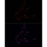 Immunofluorescence - Anti-METTL16 Antibody (A91255) - Antibodies.com