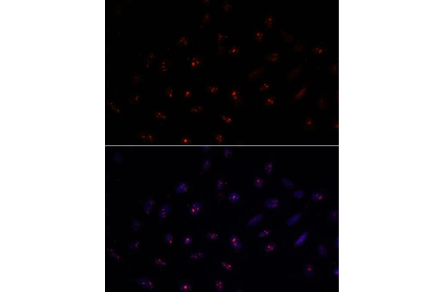 Immunofluorescence - Anti-METTL16 Antibody (A91255) - Antibodies.com