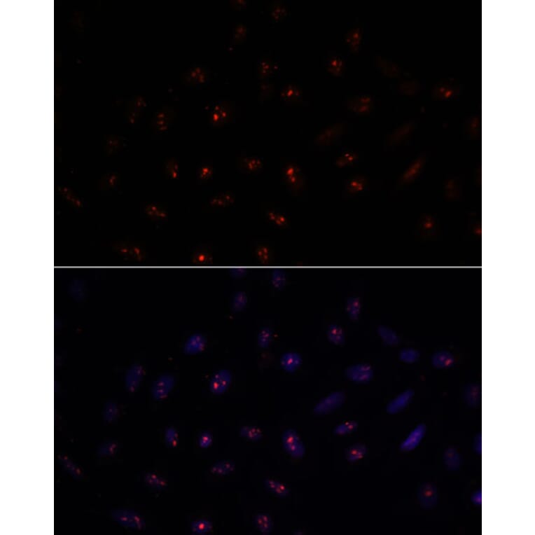 Immunofluorescence - Anti-METTL16 Antibody (A91255) - Antibodies.com