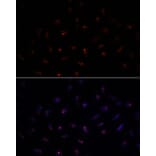 Immunofluorescence - Anti-METTL16 Antibody (A91255) - Antibodies.com