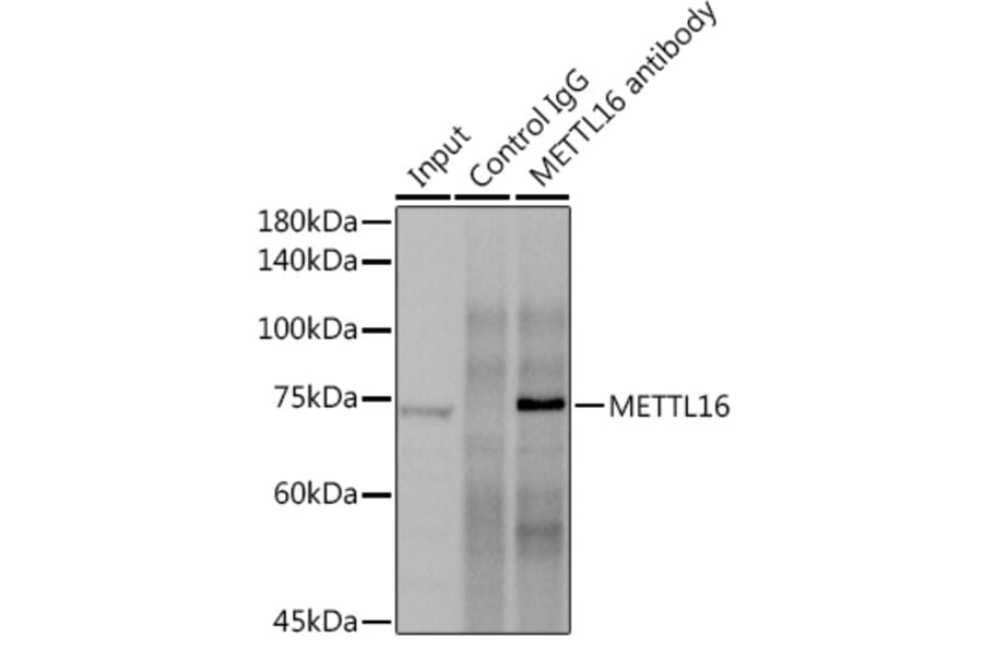 Western Blot - Anti-METTL16 Antibody (A91255) - Antibodies.com