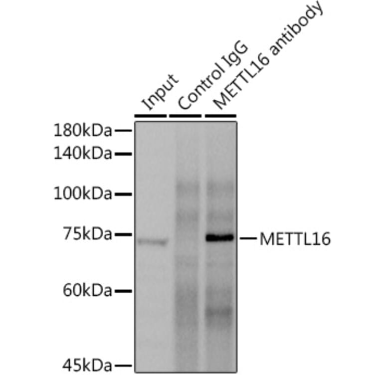 Western Blot - Anti-METTL16 Antibody (A91255) - Antibodies.com