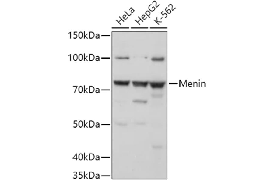 Western Blot - Anti-Menin Antibody (A91256) - Antibodies.com