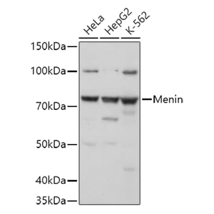 Western Blot - Anti-Menin Antibody (A91256) - Antibodies.com