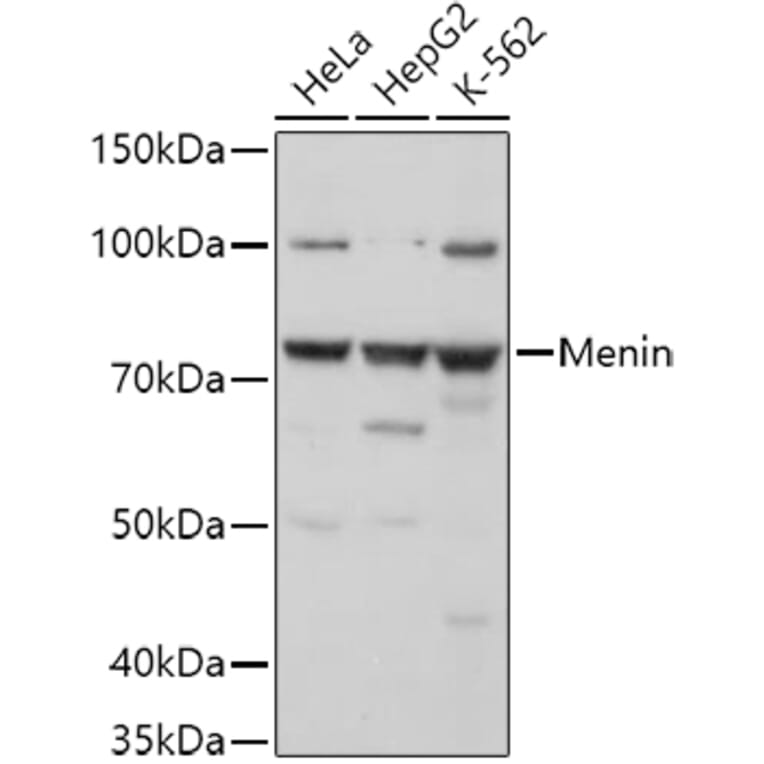 Western Blot - Anti-Menin Antibody (A91256) - Antibodies.com