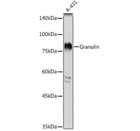 Western Blot - Anti-Granulin Antibody (A91257) - Antibodies.com