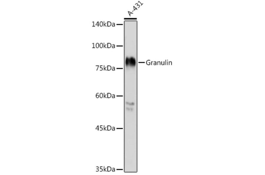 Western Blot - Anti-Granulin Antibody (A91257) - Antibodies.com