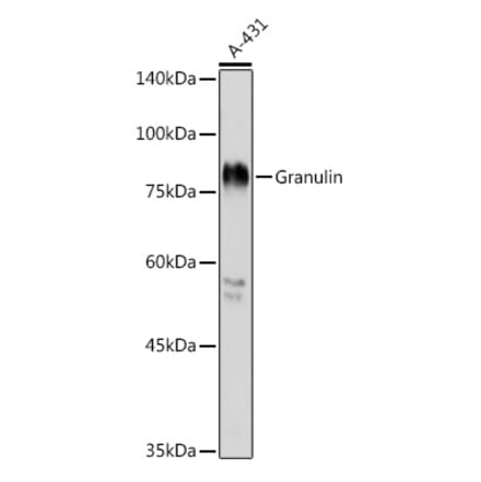 Western Blot - Anti-Granulin Antibody (A91257) - Antibodies.com