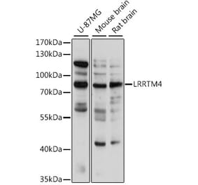 Western Blot - Anti-LRRTM4 Antibody (A91258) - Antibodies.com