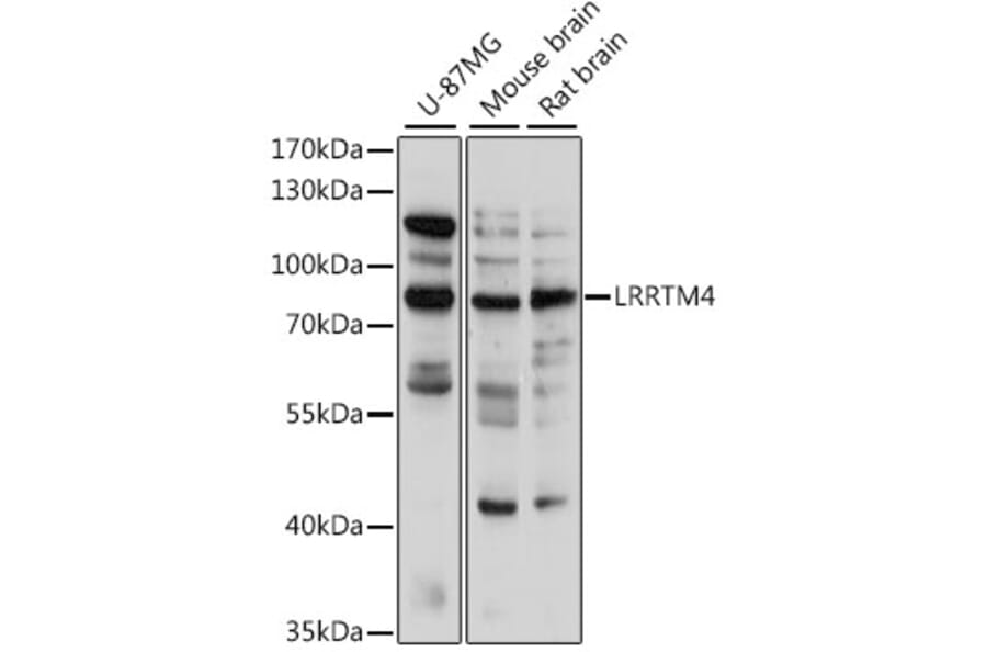 Western Blot - Anti-LRRTM4 Antibody (A91258) - Antibodies.com