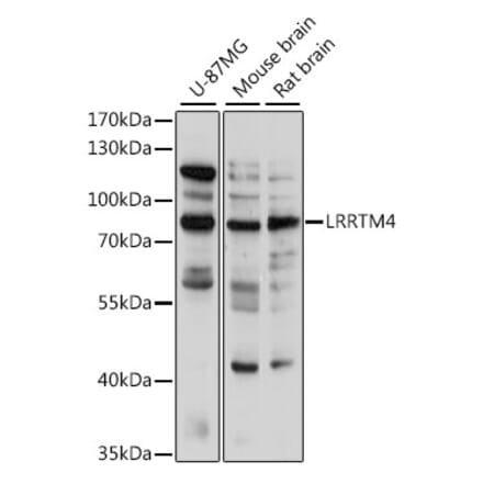 Western Blot - Anti-LRRTM4 Antibody (A91258) - Antibodies.com