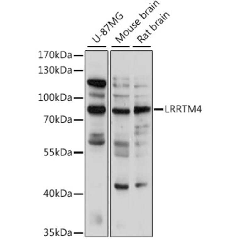Western Blot - Anti-LRRTM4 Antibody (A91258) - Antibodies.com