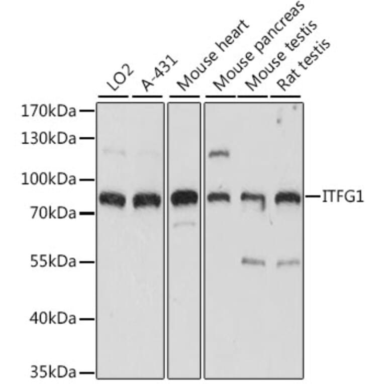 Western Blot - Anti-ITFG1 Antibody (A91259) - Antibodies.com