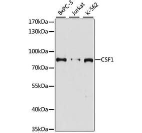 Western Blot - Anti-M-CSF Antibody (A91261) - Antibodies.com