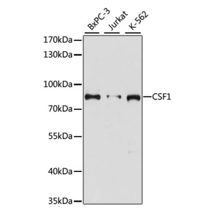 Western Blot - Anti-M-CSF Antibody (A91261) - Antibodies.com