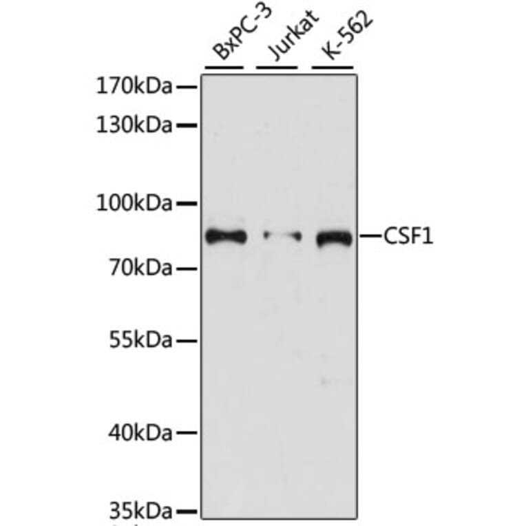 Western Blot - Anti-M-CSF Antibody (A91261) - Antibodies.com
