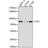 Western Blot - Anti-M-CSF Antibody (A91261) - Antibodies.com