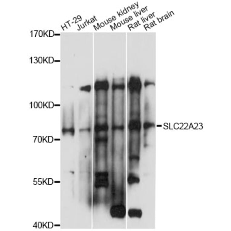 Western Blot - Anti-SLC22A23 Antibody (A14419) - Antibodies.com