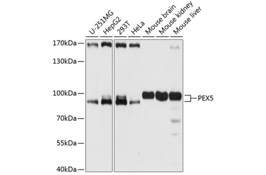 Western Blot - Anti-PEX5/PER3 Antibody (A91263) - Antibodies.com