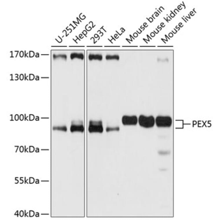 Western Blot - Anti-PEX5/PER3 Antibody (A91263) - Antibodies.com