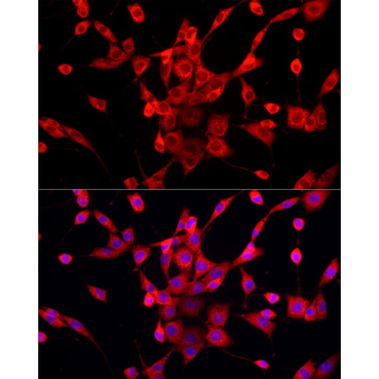Immunofluorescence - Anti-PEX5/PER3 Antibody (A91263) - Antibodies.com