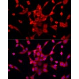 Immunofluorescence - Anti-PEX5/PER3 Antibody (A91263) - Antibodies.com