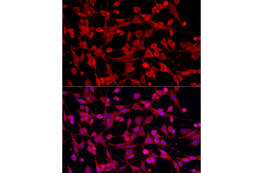 Immunofluorescence - Anti-PEX5/PER3 Antibody (A91263) - Antibodies.com