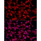 Immunofluorescence - Anti-PEX5/PER3 Antibody (A91263) - Antibodies.com