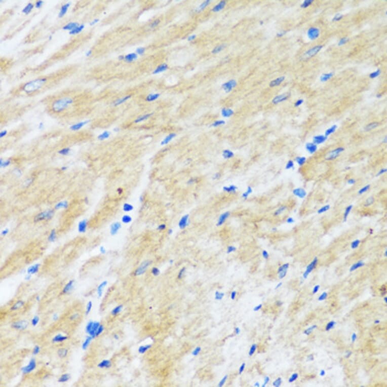 Immunohistochemistry - Anti-Bag3 Antibody (A91265) - Antibodies.com