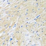 Immunohistochemistry - Anti-Bag3 Antibody (A91265) - Antibodies.com