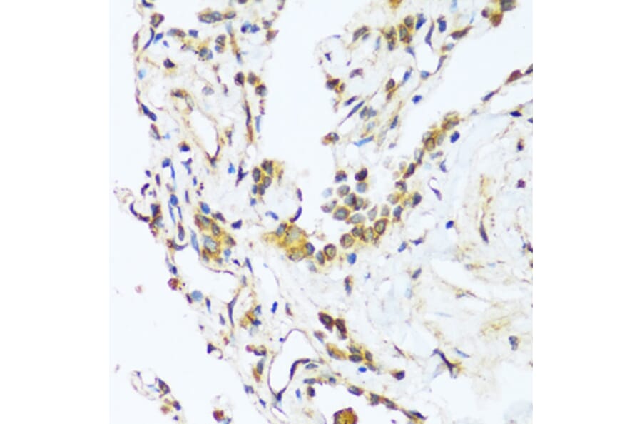 Immunohistochemistry - Anti-Bag3 Antibody (A91265) - Antibodies.com