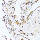 Immunohistochemistry - Anti-Bag3 Antibody (A91265) - Antibodies.com