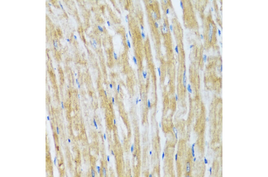 Immunohistochemistry - Anti-Bag3 Antibody (A91265) - Antibodies.com