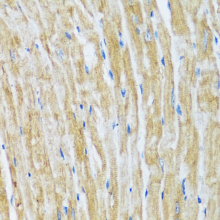 Immunohistochemistry - Anti-Bag3 Antibody (A91265) - Antibodies.com