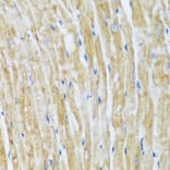 Immunohistochemistry - Anti-Bag3 Antibody (A91265) - Antibodies.com