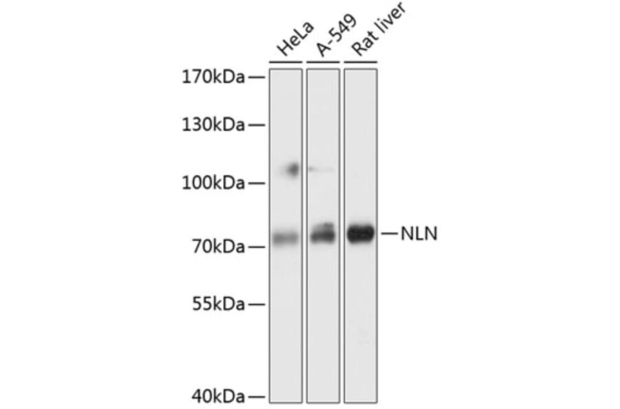 Western Blot - Anti-NLN Antibody (A91266) - Antibodies.com