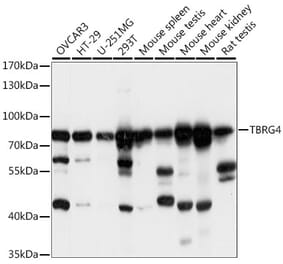 Western Blot - Anti-TBRG4 Antibody (A91267) - Antibodies.com