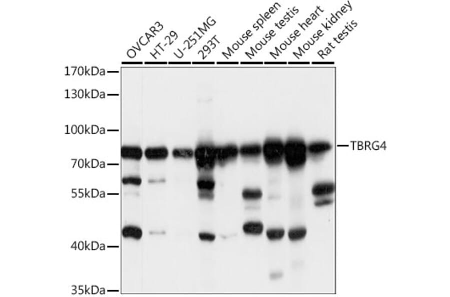 Western Blot - Anti-TBRG4 Antibody (A91267) - Antibodies.com